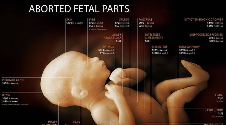 دیوید دالیدن رسواکننده کامالا هریس در تجارت اعضای بدن جنین